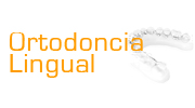 Ortodoncia Lingual